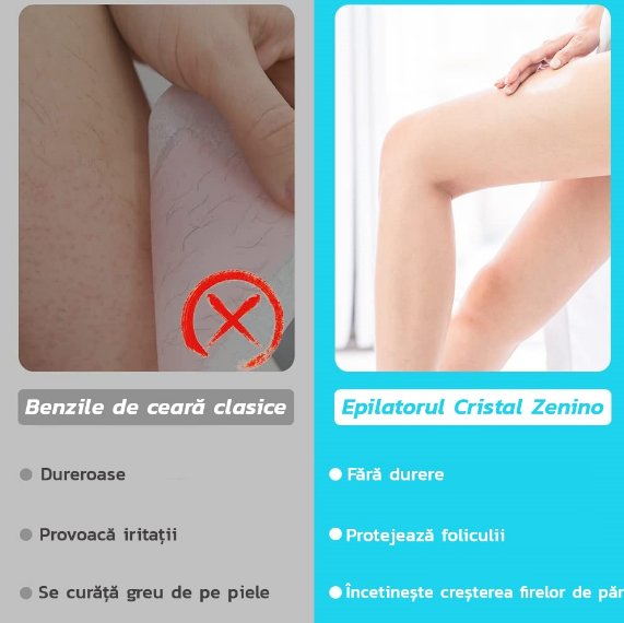 CrystalFeel - dispozitiv de indepartare a parului cu nano-cristale